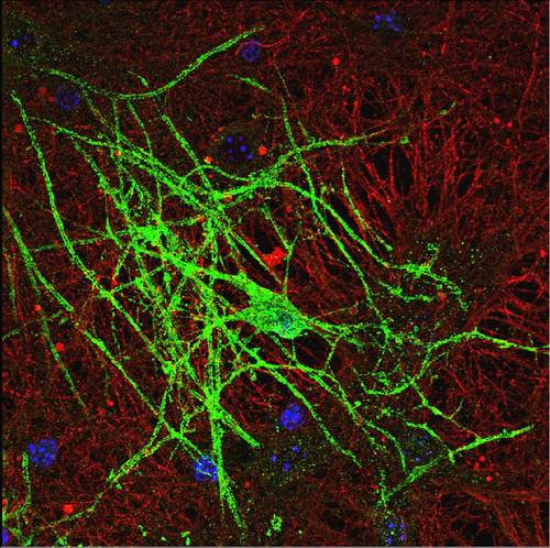 Posting the latest news on #MultipleSclerosis, neurodegeneration & myelin biogenesis research. PhD in Neuroscience, communications enthusiast.