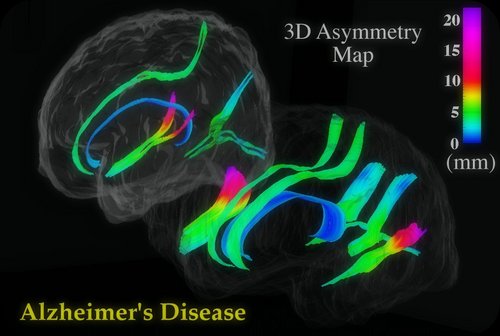 Licenciado en Psicologia
Máster en Cerebro y Conducta
Perfil Profesional: Neuropsicología Clínica
Doctorado en Neuropsicología