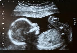 iamteenmom's profile picture. 13 years of age, and up the duff again. love my little girl xoxoxox