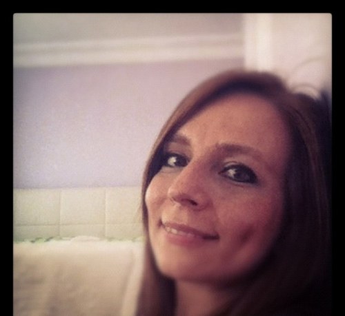 jasjasjasjasjas's profile picture. vokal anestezi, narkozitör