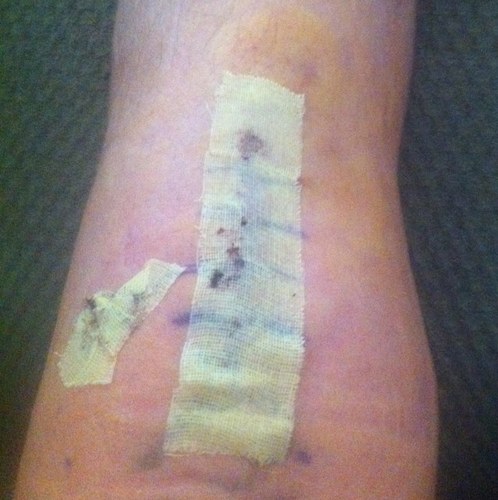 ACLTearProbz's profile picture. 