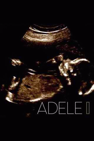 CarolynBlue21's profile picture. I love music I like writing music I'm a DayDreamer 4 life and my favorite singer is my One and Only ADELE