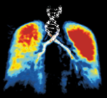 We are the University of Leicester's Breathless Genes exhibit at the Royal Society Summer Science Exhibition 2012 from 2-8 July