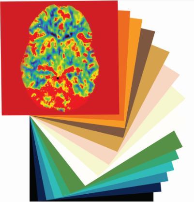 Image Management Services, Therapeutic Expertise, Clinical Trial Technologies, Deep Learning & AI. #ClinicalTrials #ArtificialIntelligence #AI #DeepLearning