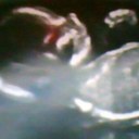 Emily-Rose Lockwood - @EmilyHLA - Twitter