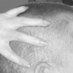 Thalidomide (@thalidomide50) Twitter profile photo Thalidomide (@thalidomide50) Twitter profile photo