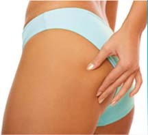 Tips and advice on how to combat celluilte FAST