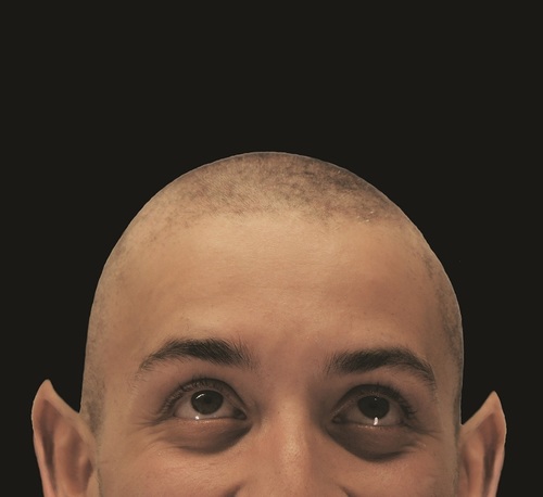 DULOG presents Bat Boy at the Edinburgh Fringe 2012! Catch the show - 21:05 @Cvenues C-1, Chambers Street, 1st-27th August. Tweets by @DougGibbs