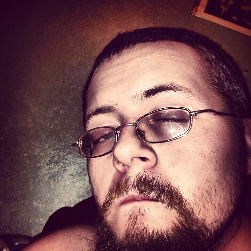 . I have Multiple Slerosis and CCSVI. I am trying to raise money to have a procedure that will correct  my blood flow from my brain. plz help if you can.