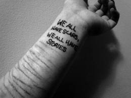 Recently been diagnosed with Borderline Personality disorder, suffers from depression and anxiety and Self harm to cope.