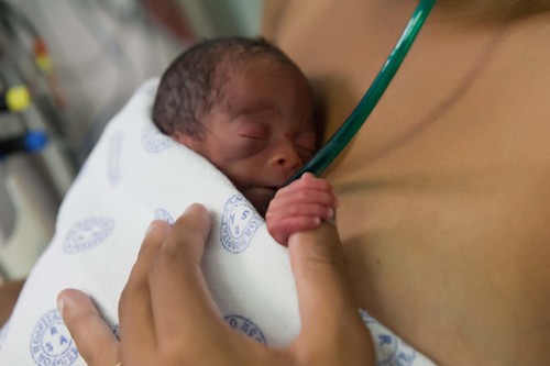 The South African Breastmilk Reserve (NPO) collects and distributes donated breastmilk to prematurely born infants in the NICU's in South Africa.