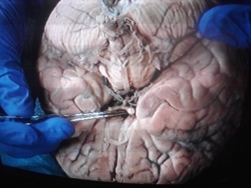 LisaChristiani1's profile picture. Medically fragile, mom of 2, married to the worlds most wonderful husband