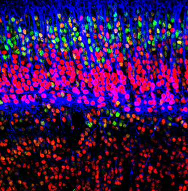 The Young-Pearse lab focuses on the identification of the mechanistic causes of neurodegenerative and developmental disorders of the nervous system.