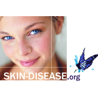 Information about Skin disease treatment, skin care, dermatology, various skin infections, fungal infections and disease.