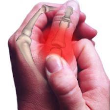 HandJointPain's profile picture. Information on hand pain, arthritis, conditions, causes, diagnosis, symptoms, pain relief, prevention, surgery and other treatment options.