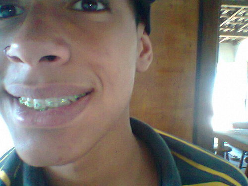 Coringaaa!