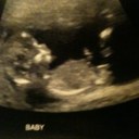 Dale Burrows - @burrowsdale - Twitter