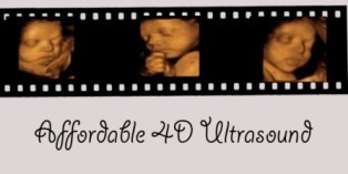 Houston's Affordable 3D/4D baby ultrasound center! 4D ultrasound packages starting at only $60.00 and Gender Reveals for only $50.00