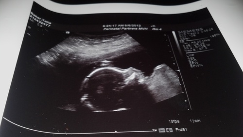 I'm a Dad-To-Be & thought it would be fun to share my journey to fatherhood with anyone who's interested. Follow me on the trip of a lifetime.