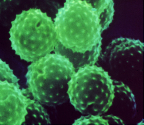 AllergyTele's profile picture. Doctor (Allergy/Immunology), husband, father, hiker, nature photographer, gardener, amateur pianist, foodie (chocolate & cheese), love a good mystery novel.