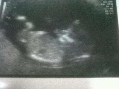03.02.13! my baby.  rest in peace mummyX