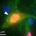 Meller Lab (@strokelab) Twitter profile photo