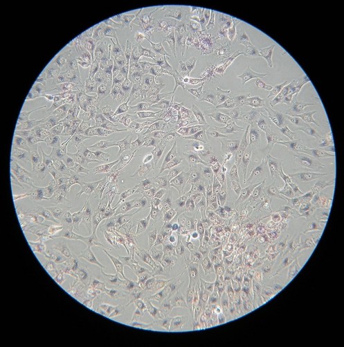 Recent News about the Role of #RTK in #Cancer