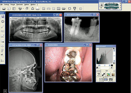 Representantes de Carestream dental By Kodak.