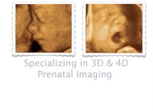 miraclesimaging's profile picture. Ultrasound Diagnostic Center specializing in 3/4D. Office:Lehigh Acres,Fl. Mobile services offered throughout Florida. 239-849-9341. http://t.co/U1laQ1ghiA