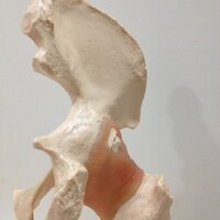 Bones&Joints Clinic(@drmkreddy78) 's Twitter Profile Photo