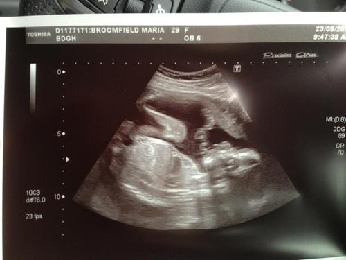 Riding the M.E/Fibro rollercoaster but blessed with my baby boy due in January 2013
UK