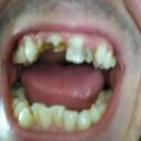 Casey Choate - @ThaMangla - Twitter