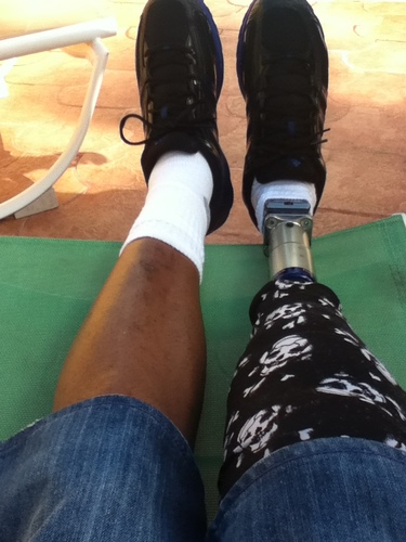 I'm a below the knee amputee