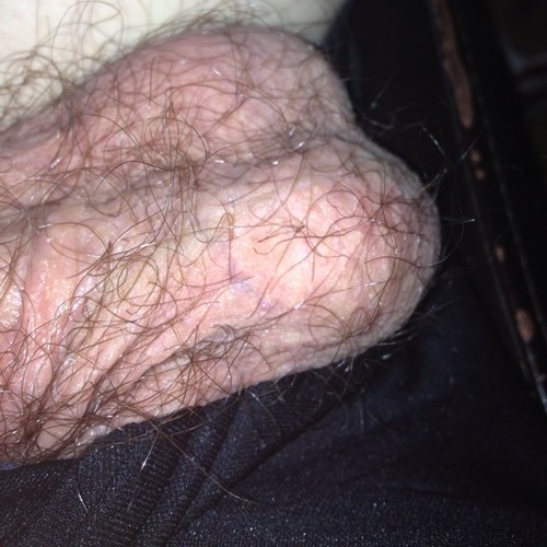 Hairy Balls Pics 60