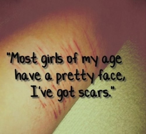 Ask_Genevieve's profile picture. Genevieve•18•Depressed•Cutter•ED• I'm here for you to ask me questions and to give you advice. Ask me anything.