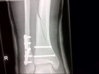 barrettjason6's profile picture. 