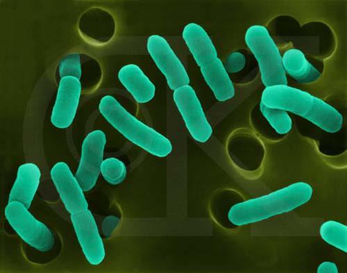 I am E.coli O157:H7. Be aware, I am not like the other E.Coli serotypes.