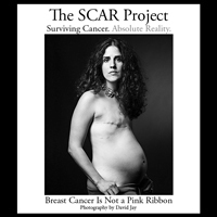 The SCAR Project puts a raw, unflinching face on early onset breast cancer while paying tribute to the courage and spirit of so many brave young women.