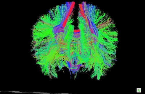 DrReactivity's profile picture. Researcher in the neuroscience of stress reactivity and its cognitive correlates