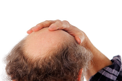 Haarausfall_'s profile picture. Bei Haarausfall und Glatze hilft oft nur eine Haarverpflanzung oder Haartransplantation. Mehr Informationen dazu gibt es hier und auf meiner Website. Impressum: