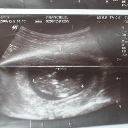 baby a kminho !! para nossa alegria