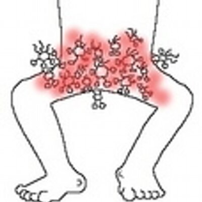 疣状白癬菌 T Verrucosum Twitter 疣状白癬菌 T Verrucosum Twitter