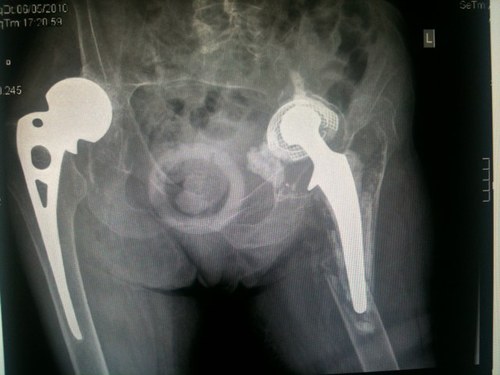 mfneligan's profile picture. Orthopaedic surgeon, Interested in future healthcare direction. 4 great young men on the team and Grace.