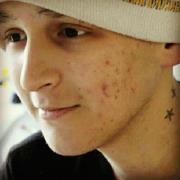 Fundraising effort to help Nathan Robertson and his family with his fight against Burkett's Disease.