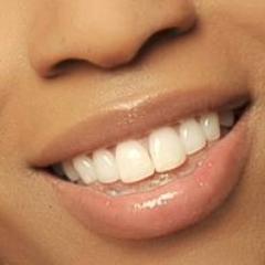 stripsrus's profile picture. Bringing brighter whiter smiles to everyone!