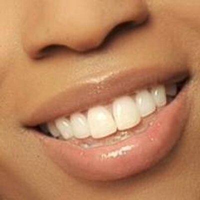 dry touch whitening trays