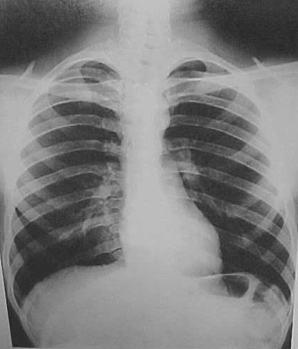 BlinnRadTech's profile picture. Blinn Radiologic Technology Program has an advising group to help out prospective students - please join us!