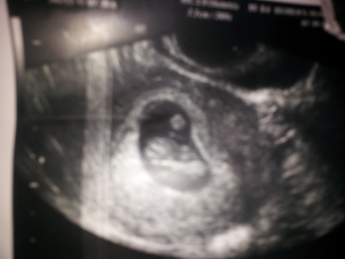 Sh8nkers's profile picture. Husband (to Kassie) and follower of Christ.