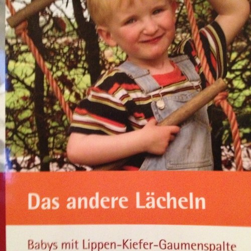 Das Buch: Das andere Lächeln - Babys mit Lippen-Kiefer-Gaumenspalte von Kirsten Caspers
