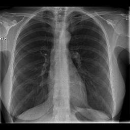 afdeling radiologie in het Ziekenhuis Rivierenland Tiel.
Voor diagnostiek zoals röntgenfoto's, echografie, CT en MRi scans.